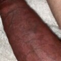 Profile picture of SF FORESKINPIG