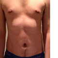 Profile picture of NippleLad